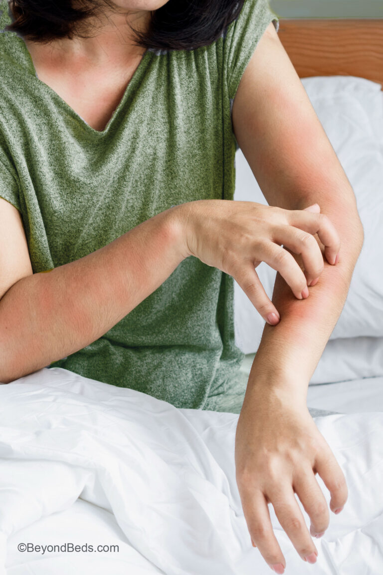 A woman sitting in bed, scratching her ankles, showing discomfort possibly caused by bird mite bites.