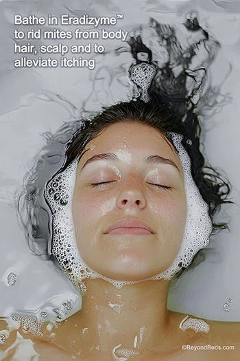 A young woman with long black hair is soaking in a tub containing just 1 to1.5 ounce of Eradizyme. She is submerged up to her hairline, undergoing treatment to remove mites from her scalp and body hair.